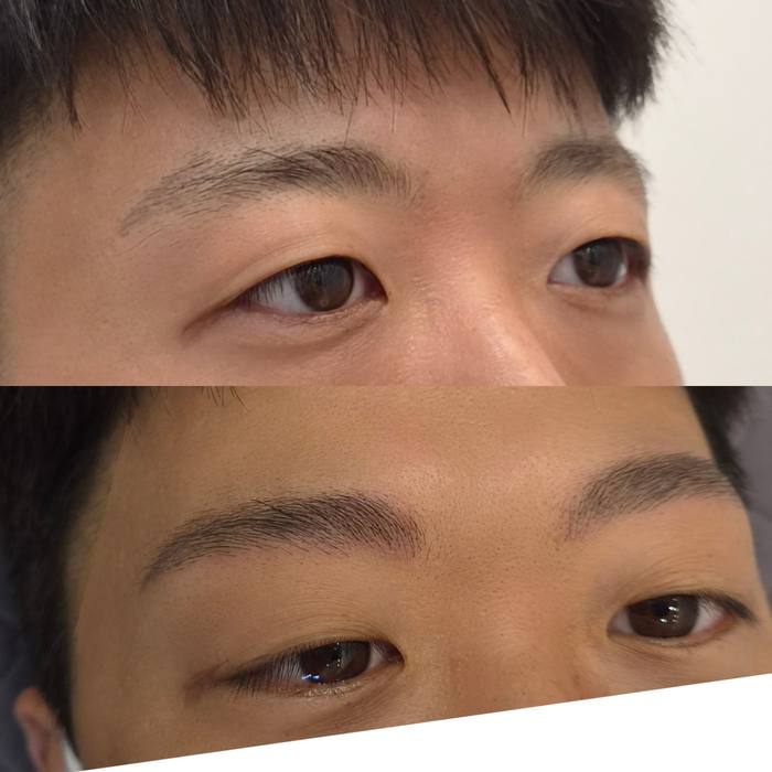 남자눈썹 헤어스트로크 실제 시술 사례