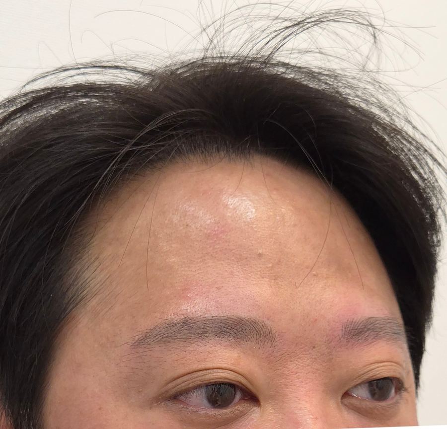 남자눈썹 실제 고객 사진