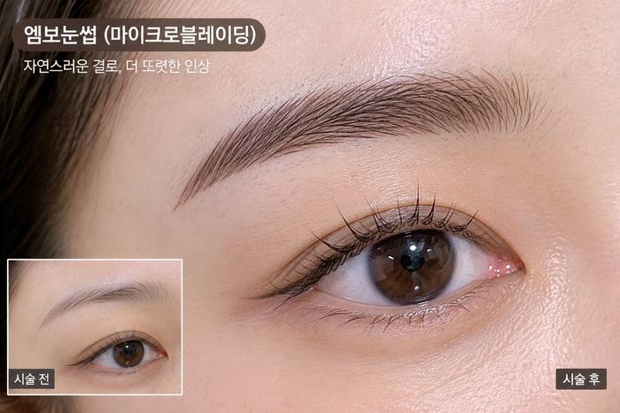 엠보눈썹 설명 이미지