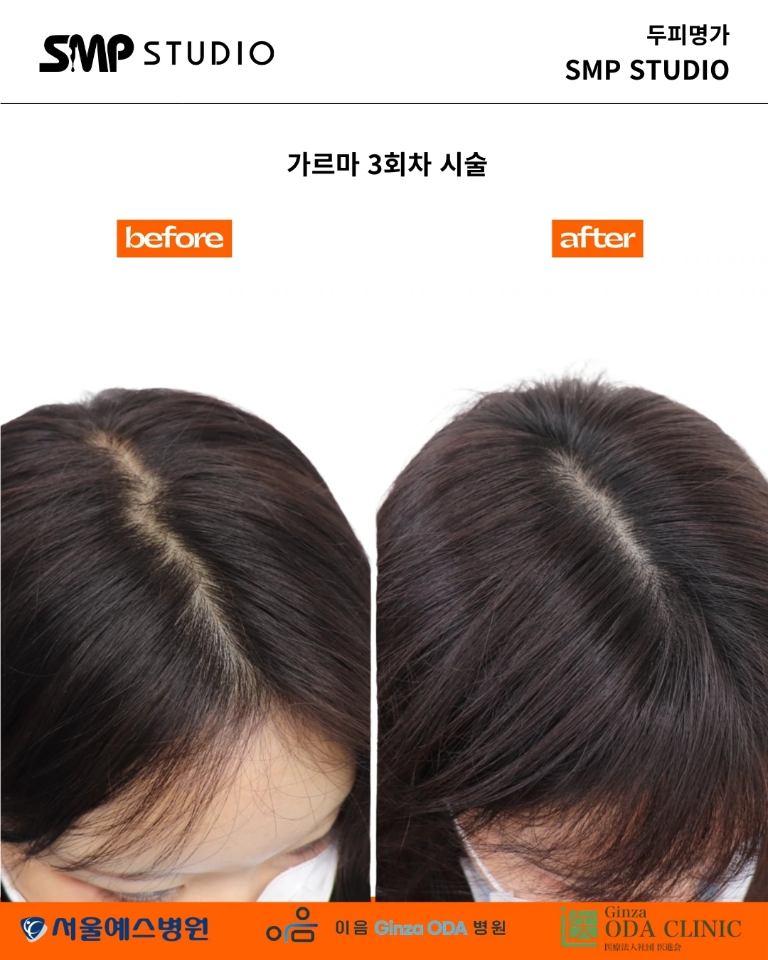 SMP스튜디오 제공 가르마 사진 기록 001
